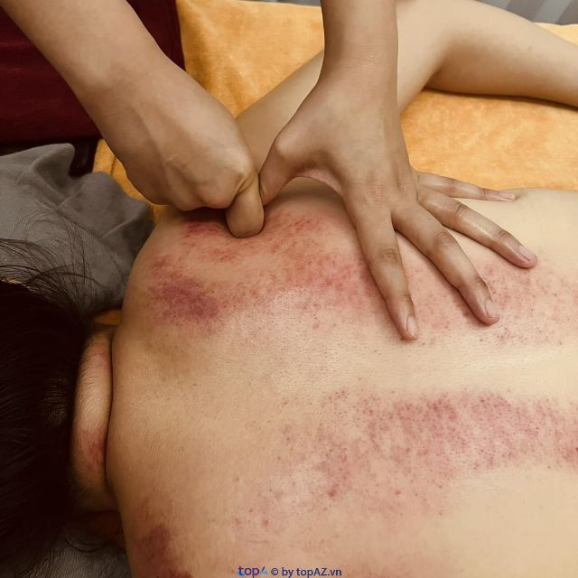 Nhân viên Spa Mộc Linh Đường đang thực hiện massage trị liệu