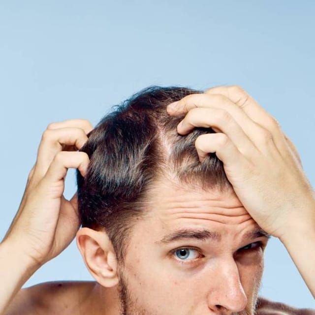 Thói quen tạo kiểu sai lầm như buộc tóc quá chặt có thể gây rụng tóc do lực kéo