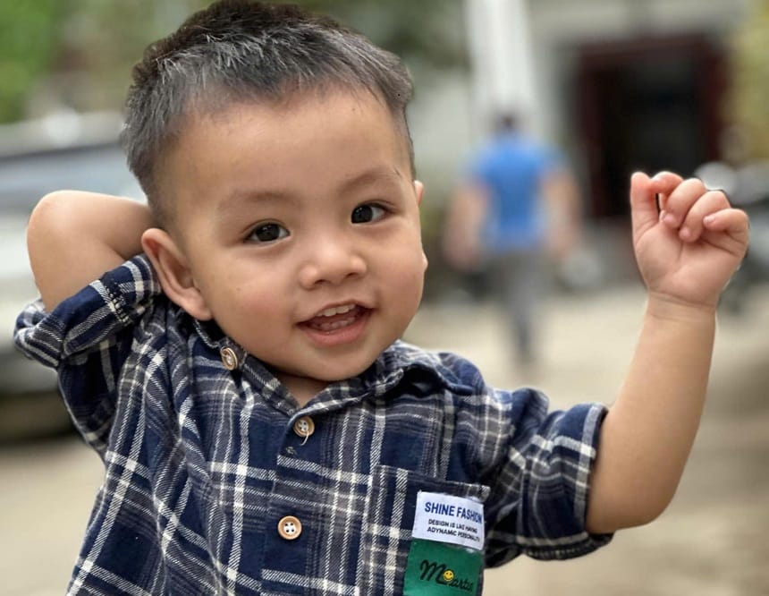Bé trai 5 tuổi có da đầu tương đối nhạy cảm